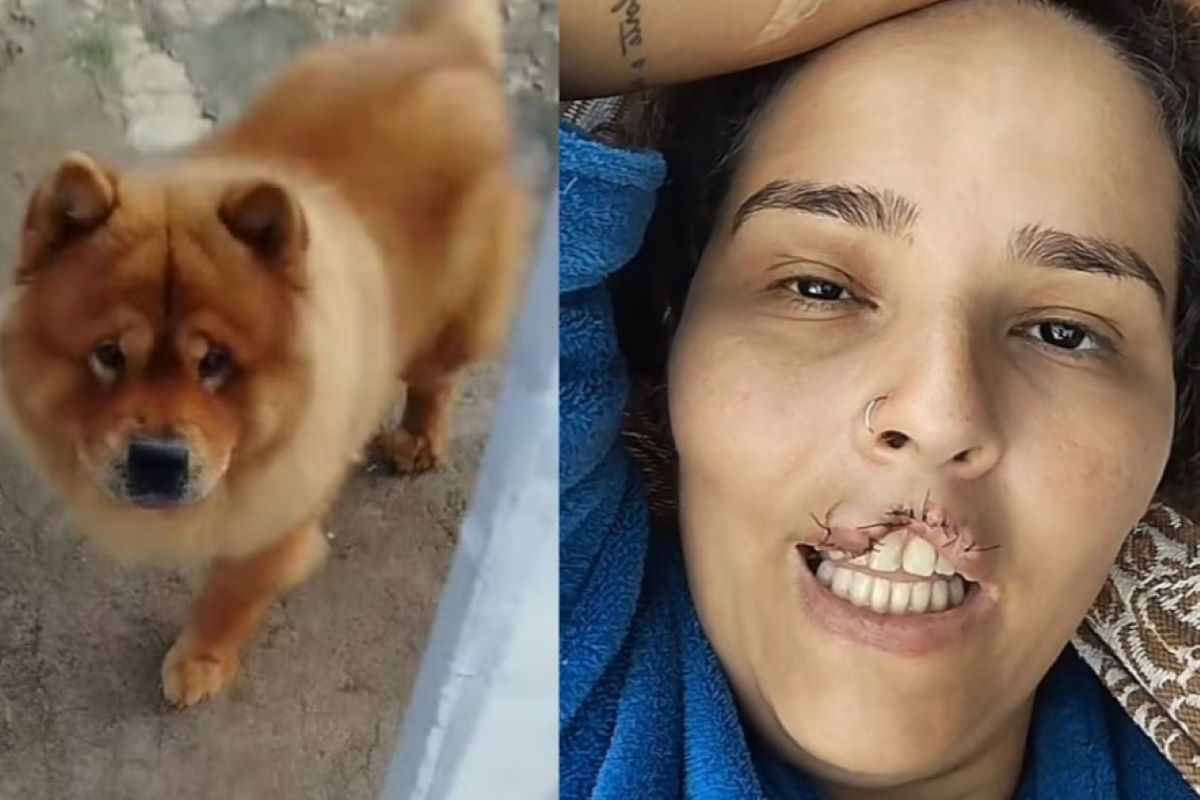 Cachorro chow-chow arranca lábio de tutora e é submetido a eutanásia