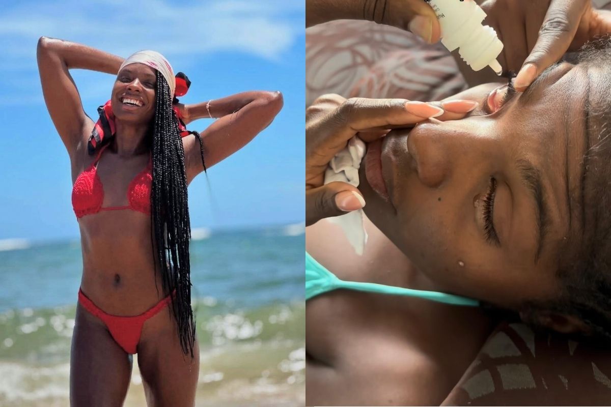 Modelo perde a visão por 7 dias após usar pomada modeladora no cabelo