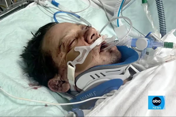 Ator da Marvel afirma que “morreu” em acidente e relata experiência