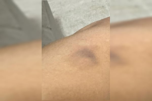 Advogada presa por agressão se defende e mostra fotos de lesões: veja