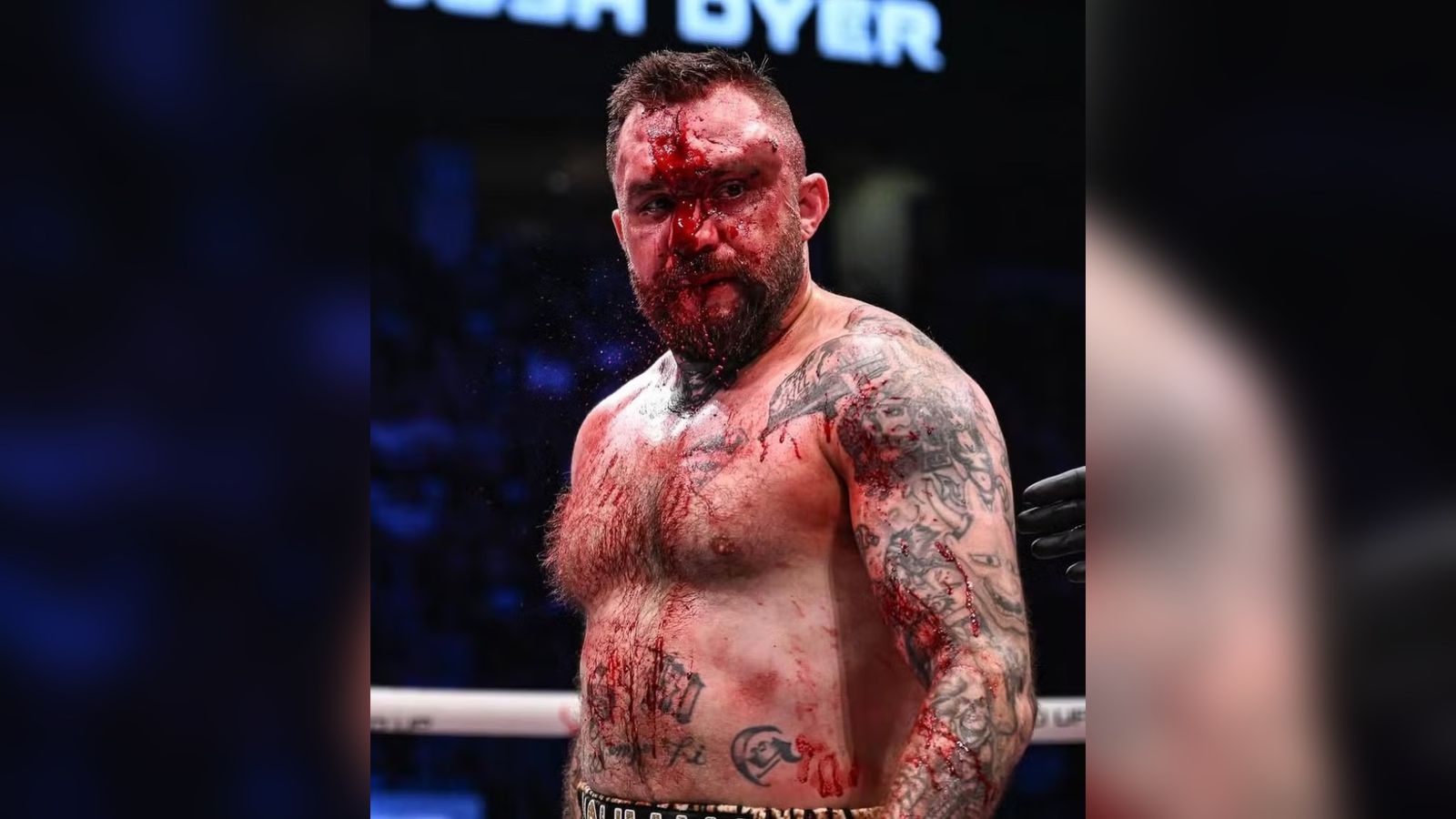 Imagens fortes: boxeador publica foto do rosto cortado após luta