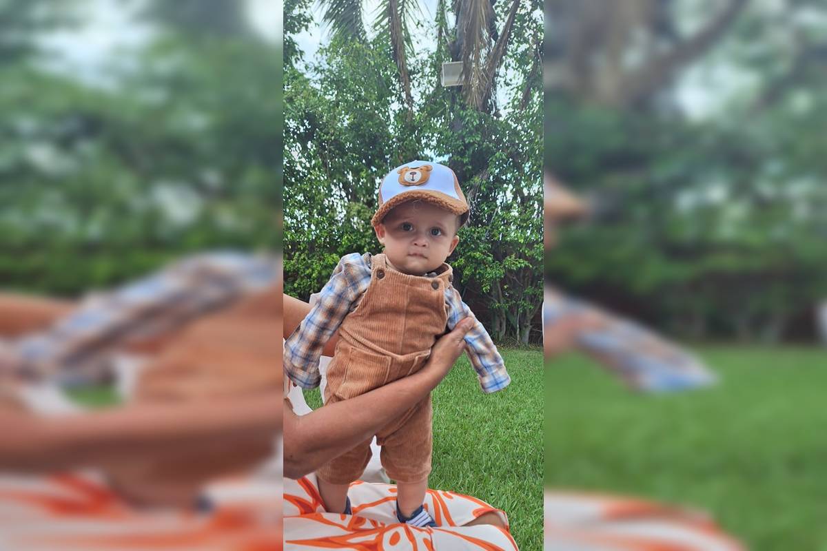 Família de bebê com deformidade faz vaquinha para comprar capacete