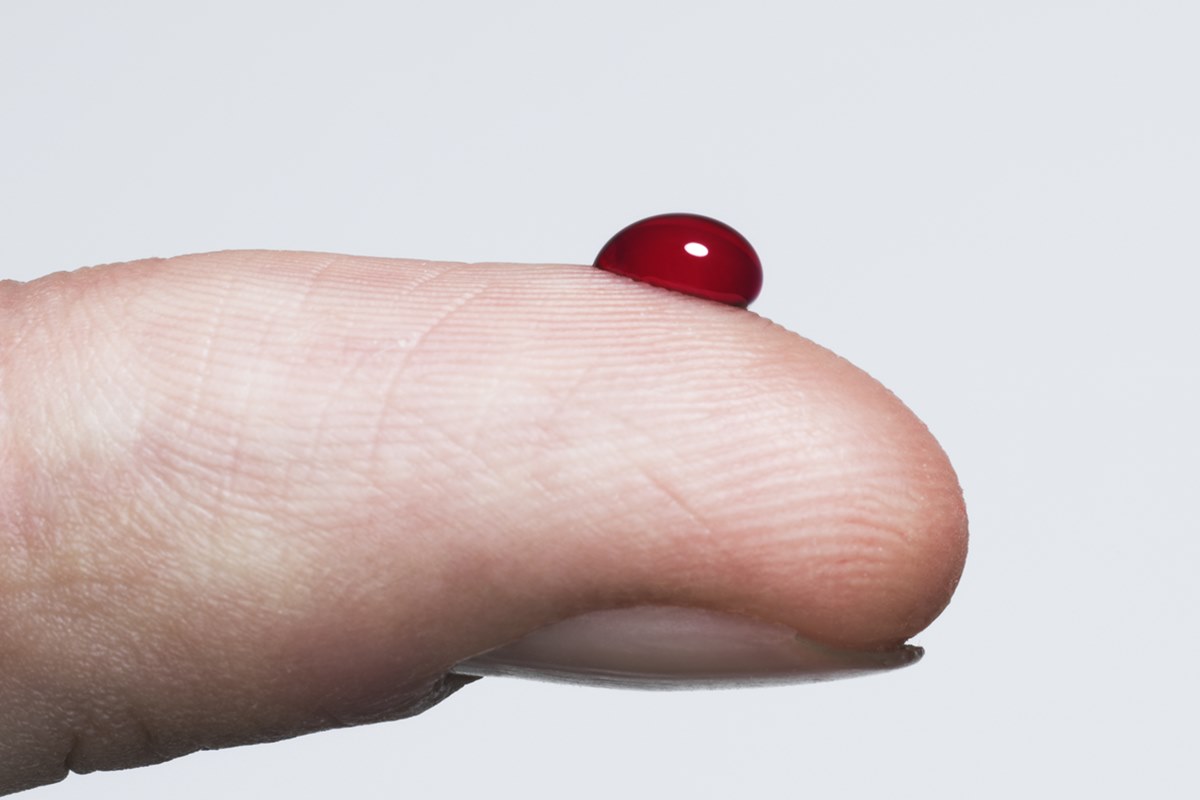 Por que agora é indicado rastrear diabetes tipo 2 a partir dos 35?