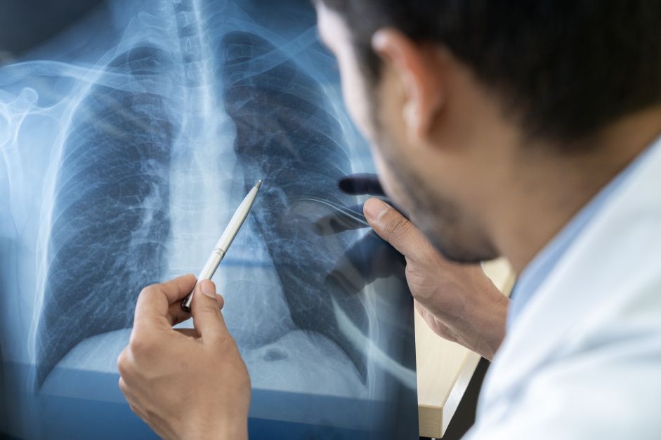 Entenda o que é pneumonia silenciosa, que tem alertado autoridades de saúde
