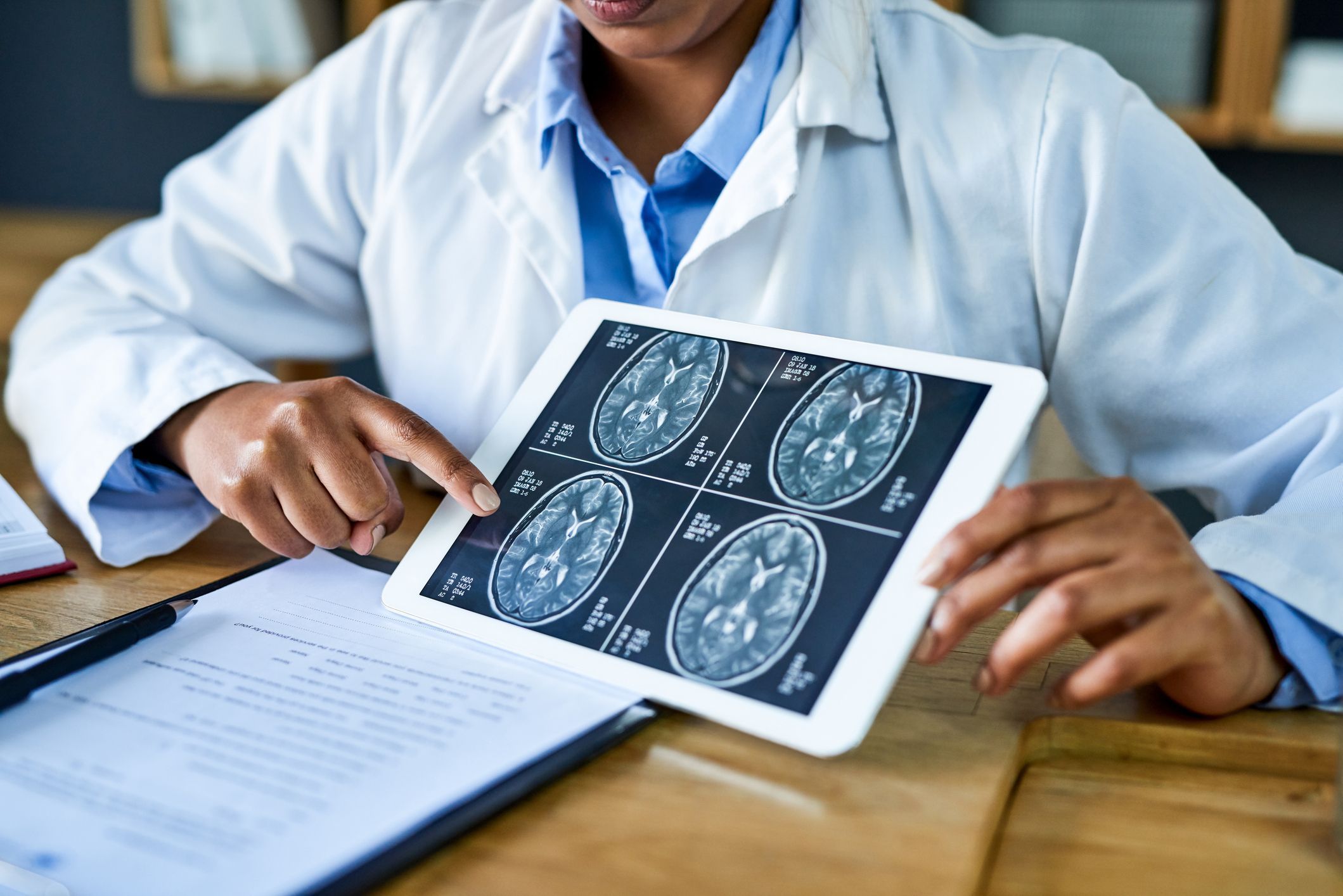 Oncologista a Kalil: Incidência de tumor cerebral não é alta, mas assusta