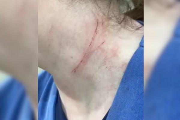 Vídeo: mulher empurra e enforca enfermeiras dentro de UPA em São Paulo