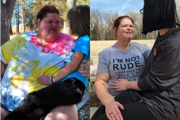 Quilos Mortais: veja como estão tia e sobrinho que pesavam 564 kg