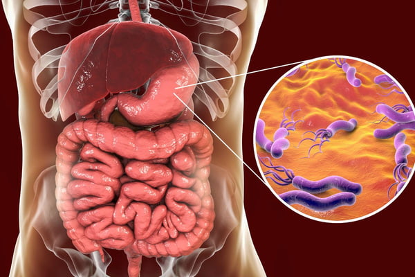 Médico revela qual é o alimento n° 1 que ajuda a combater a H. pylori