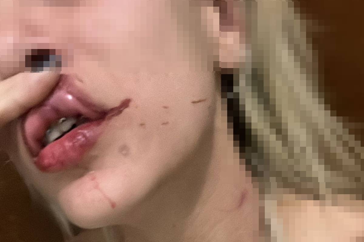 PM do DF é acusado de usar viatura para perseguir ex após agressões