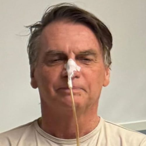 Bolsonaro deixa UTI nesta quarta-feira, 17 dias após cirurgia