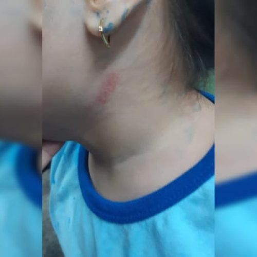 Professora acusada de agredir criança de 4 anos é afastada de escola
